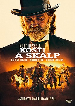 kosti-a-skalp